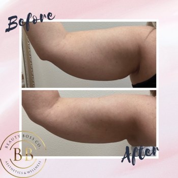 Beauty Boss Aesthetics And Wellness gallery image 3