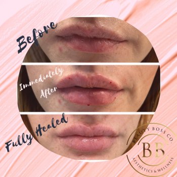 Beauty Boss Aesthetics And Wellness gallery image 4