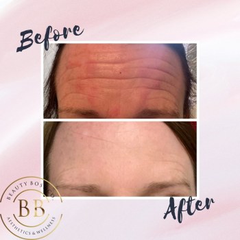 Beauty Boss Aesthetics And Wellness gallery image 2